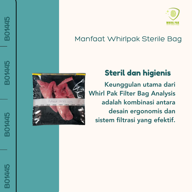 Nasco Whirl Pak Filter Bag Analysis (2).png